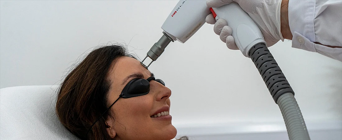 Fractional Erbium Laser